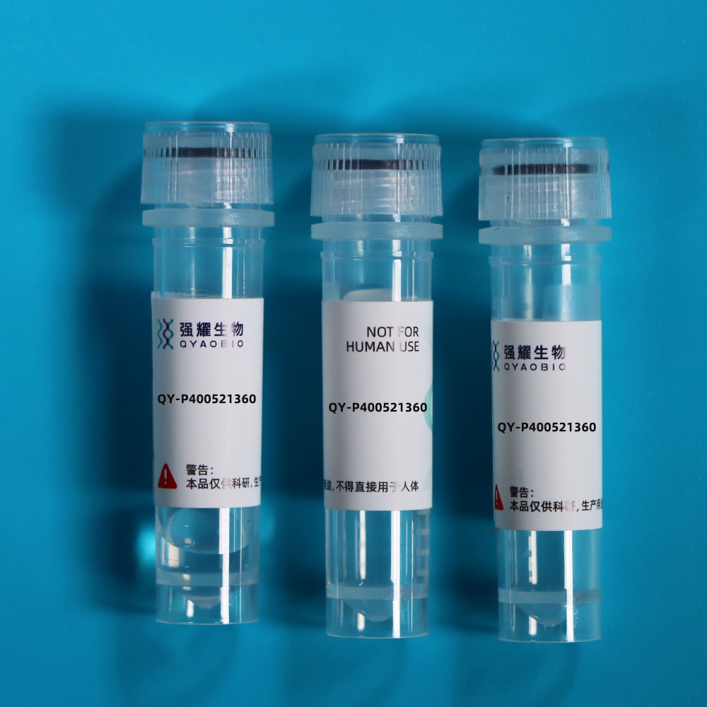 Recombinant Transmembrane Protease, Serine 2 (TMPRSS2)